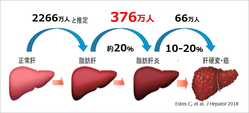 （出典：Estes C, et al. J Hepatol 2018／資料提供：尾形哲医師）