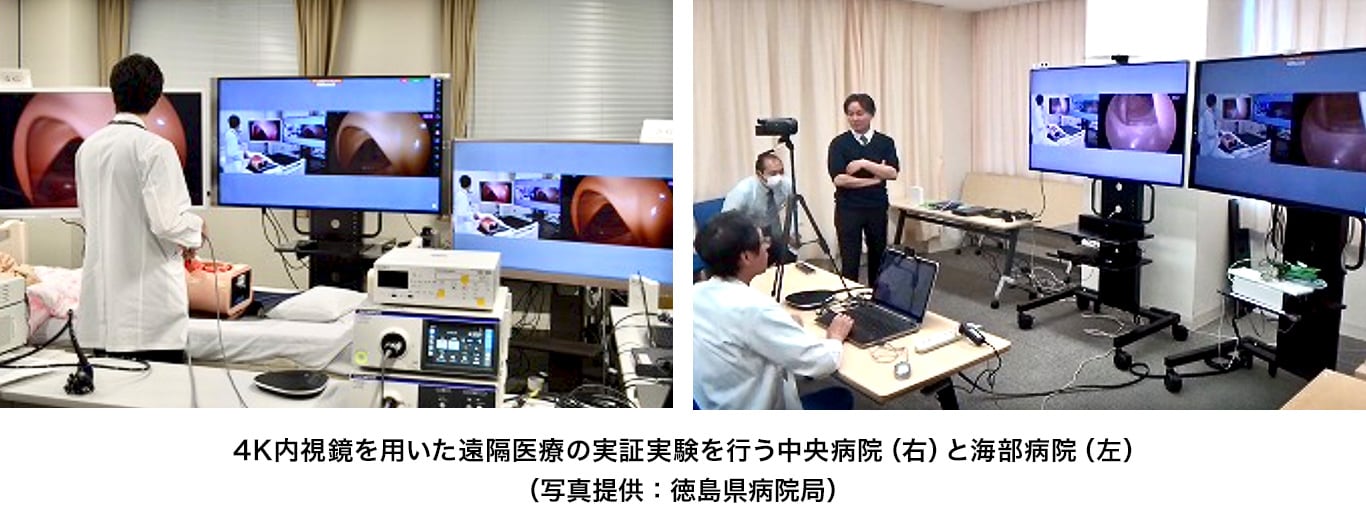 4K内視鏡を用いた遠隔医療の実証実験を行う中央病院（右）と海部病院（左）（写真提供：徳島県病院局）