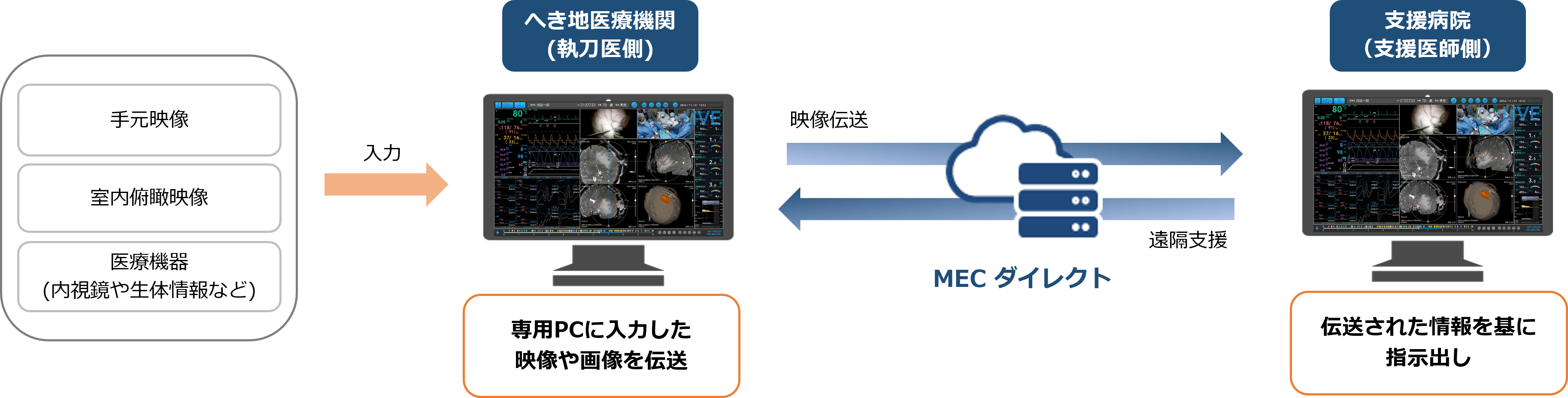 手元映像・室内俯瞰映像・医療機器（内視鏡や生体情報など）　→入力→　へき地医療機関（執刀医側）：専用PCに入力した映像や画像を伝送　MECダイレクト（→映像伝送　←遠隔支援）　支援病院（支援医師側：伝送された情報を基に指示出し）