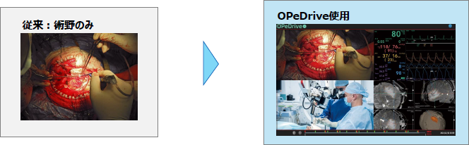 従来：術野のみ　→　OpeDrive使用時の画面